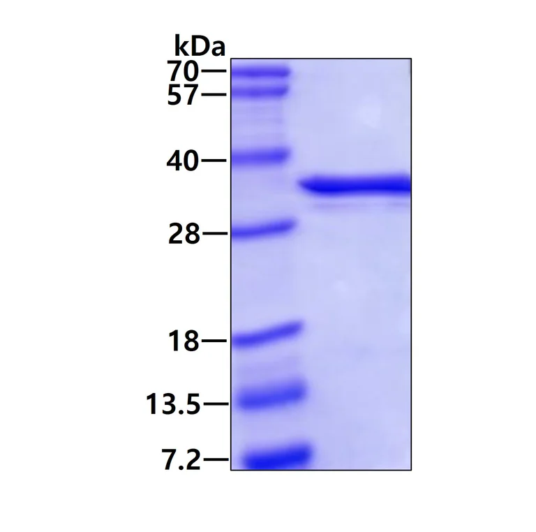 SDS-PAGE - Recombinant Human SCGN/Secretagogin protein (His tag N-Terminus) (AB99417)