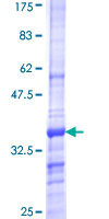 SDS-PAGE - Recombinant Human SCN2A protein (GST tag N-Terminus) (AB114727)