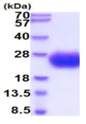 SDS-PAGE - Recombinant Human SCN3B protein (His tag) (AB222957)