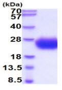 SDS-PAGE - Recombinant Human SCN3B protein (His tag C-Terminus) (AB222957)