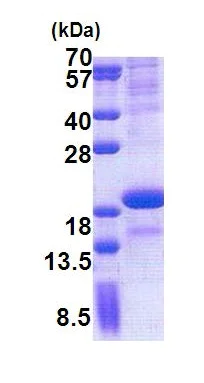 SDS-PAGE - Recombinant Human SCN3B protein (His tag N-Terminus) (AB171585)