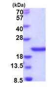 SDS-PAGE - Recombinant Human SCO1 protein (AB202238)