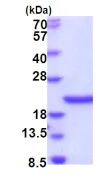 SDS-PAGE - Recombinant Human SCO1 protein (His tag C-Terminus) (AB202238)