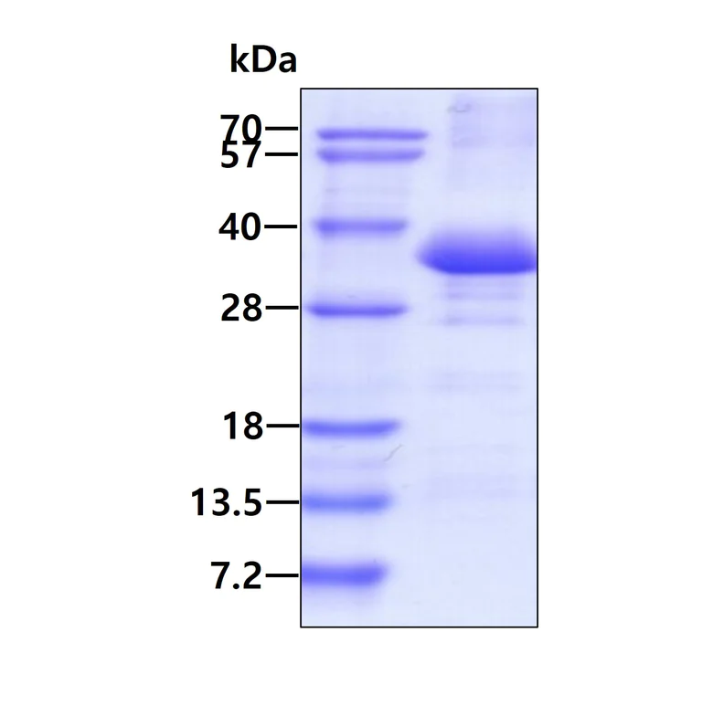 SDS-PAGE - Recombinant Human Scramblase 1 protein (His tag N-Terminus) (AB136366)