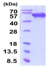 SDS-PAGE - Recombinant Human SCRN1 protein (His tag N-Terminus) (AB202177)