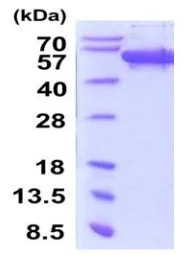 SDS-PAGE - Recombinant Human SCRN1 protein (His tag N-Terminus) (AB202177)