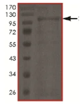 SDS-PAGE - Recombinant Human SCY1 like 3 protein (AB167935)