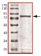 SDS-PAGE - Recombinant Human SCYL1 protein (AB135221)