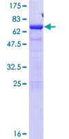 SDS-PAGE - Recombinant Human SDCCAG8 protein (GST tag N-Terminus) (AB132722)