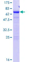 SDS-PAGE - Recombinant Human SDCCAG8 protein (GST tag N-Terminus) (AB132722)