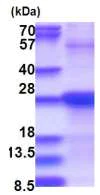 SDS-PAGE - Recombinant Human SDF2 protein (denatured) (His tag N-Terminus) (AB181895)