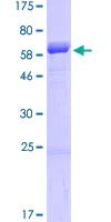 SDS-PAGE - Recombinant Human SDF4 protein (AB162434)