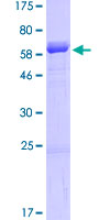 SDS-PAGE - Recombinant Human SDF4 protein (GST tag N-Terminus) (AB162434)