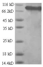SDS-PAGE - Recombinant Human SDHA protein (His tag) (AB226453)
