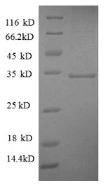 SDS-PAGE - Recombinant Human SDHA protein (Tagged) (AB226268)