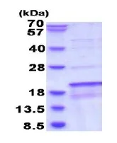 SDS-PAGE - Recombinant Human SDHAF1 protein (AB187429)