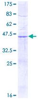 SDS-PAGE - Recombinant Human SDHD protein (AB116859)