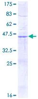 SDS-PAGE - Recombinant Human SDHD protein (AB116859)