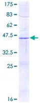 SDS-PAGE - Recombinant Human SDHD protein (GST tag N-Terminus) (AB116859)