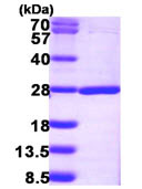 Recombinant Human SDOS protein