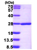 SDS-PAGE - Recombinant Human SDOS protein (AB104670)