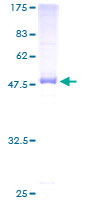 SDS-PAGE - Recombinant Human SDS protein (GST tag N-Terminus) (AB161230)