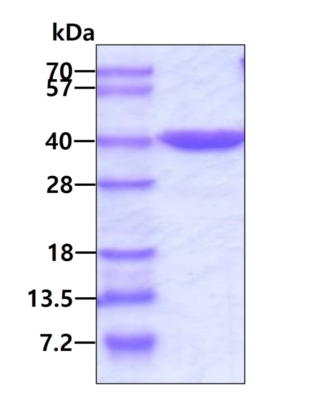 SDS-PAGE - Recombinant Human SEC13L1 protein (His tag N-Terminus) (AB105635)