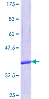 SDS-PAGE - Recombinant Human SEC14 like protein 2 (GST tag N-Terminus) (AB161678)