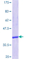 SDS-PAGE - Recombinant Human SEC14 like protein 2 (GST tag N-Terminus) (AB161678)