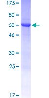 SDS-PAGE - Recombinant Human SEC14L4 protein (AB166189)