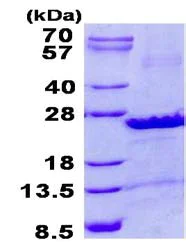 SDS-PAGE - Recombinant Human SEC22B protein (denatured) (His tag N-Terminus) (AB134537)