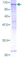 SDS-PAGE - Recombinant Human Sec24C protein (AB160588)