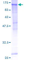 SDS-PAGE - Recombinant Human Sec24C protein (GST tag N-Terminus) (AB160588)