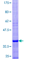 Recombinant Human SEC61B protein