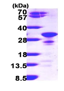 SDS-PAGE - Recombinant Human Secretogranin V protein (His tag C-Terminus) (AB100887)