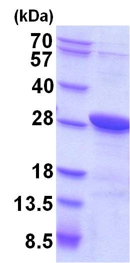 SDS-PAGE - Recombinant Human Securin protein (His tag N-Terminus) (AB87664)