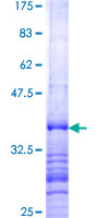 SDS-PAGE - Recombinant Human SEMA3B protein (AB152827)