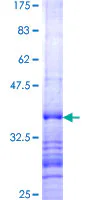 SDS-PAGE - Recombinant Human SEMA3B protein (GST tag N-Terminus) (AB152827)