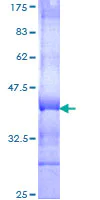 SDS-PAGE - Recombinant Human SEMA4C/SEMAI protein (AB162889)