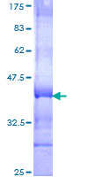 SDS-PAGE - Recombinant Human SEMA4C/SEMAI protein (GST tag N-Terminus) (AB162889)