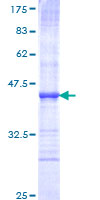 Recombinant Human Sema6A protein