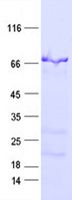 SDS-PAGE - Recombinant Human SEMG2 protein (His Tag) (AB314515)