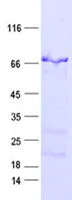 SDS-PAGE - Recombinant Human SEMG2 protein (His Tag) (AB314515)