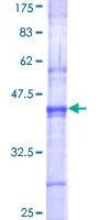 SDS-PAGE - Recombinant Human SENP3 protein (GST tag N-Terminus) (AB161918)