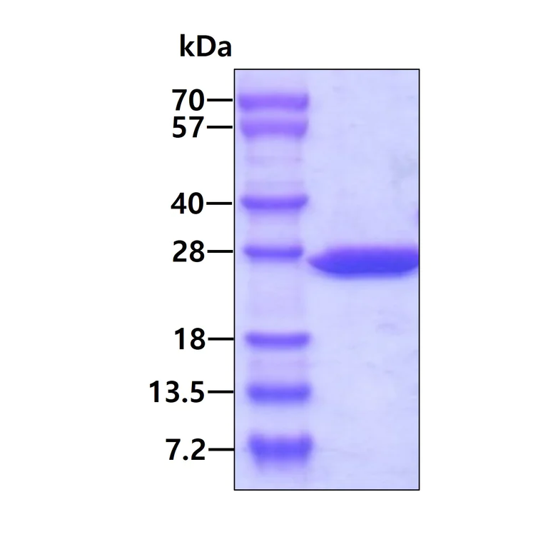 SDS-PAGE - Recombinant Human SENP8 protein (AB109837)