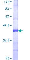 Recombinant Human Separase protein