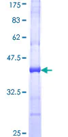 SDS-PAGE - Recombinant Human Separase protein (AB153009)