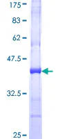 SDS-PAGE - Recombinant Human Separase protein (GST tag N-Terminus) (AB153009)