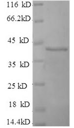 SDS-PAGE - Recombinant Human SEPP1 protein (His tag) (AB235969)