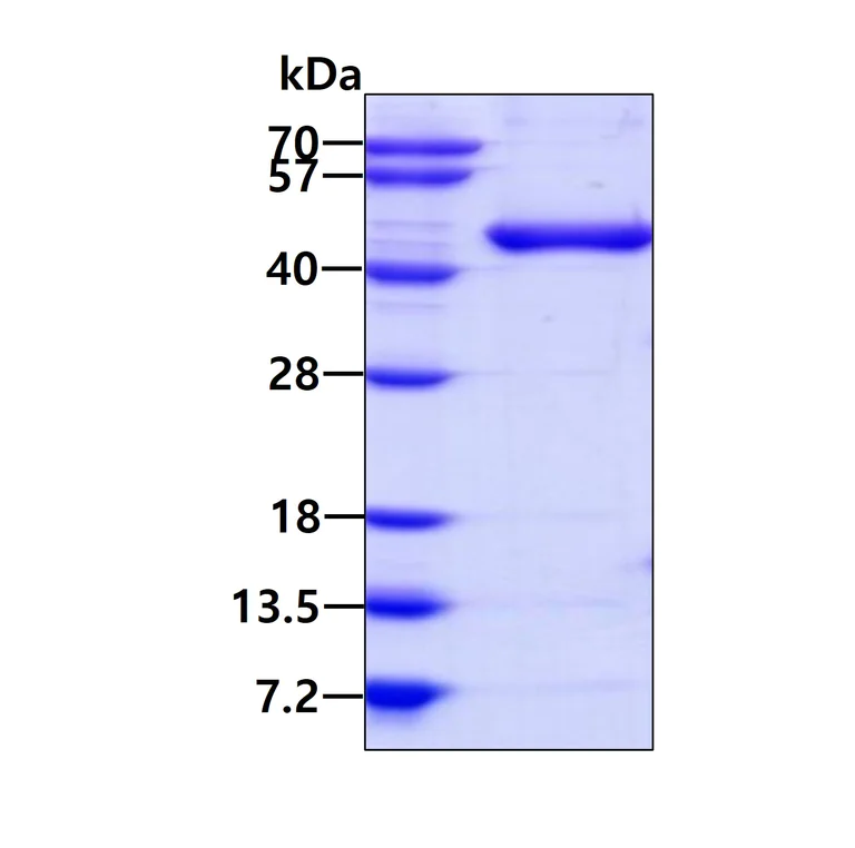 SDS-PAGE - Recombinant Human SEPT5 protein (His tag N-Terminus) (AB109972)